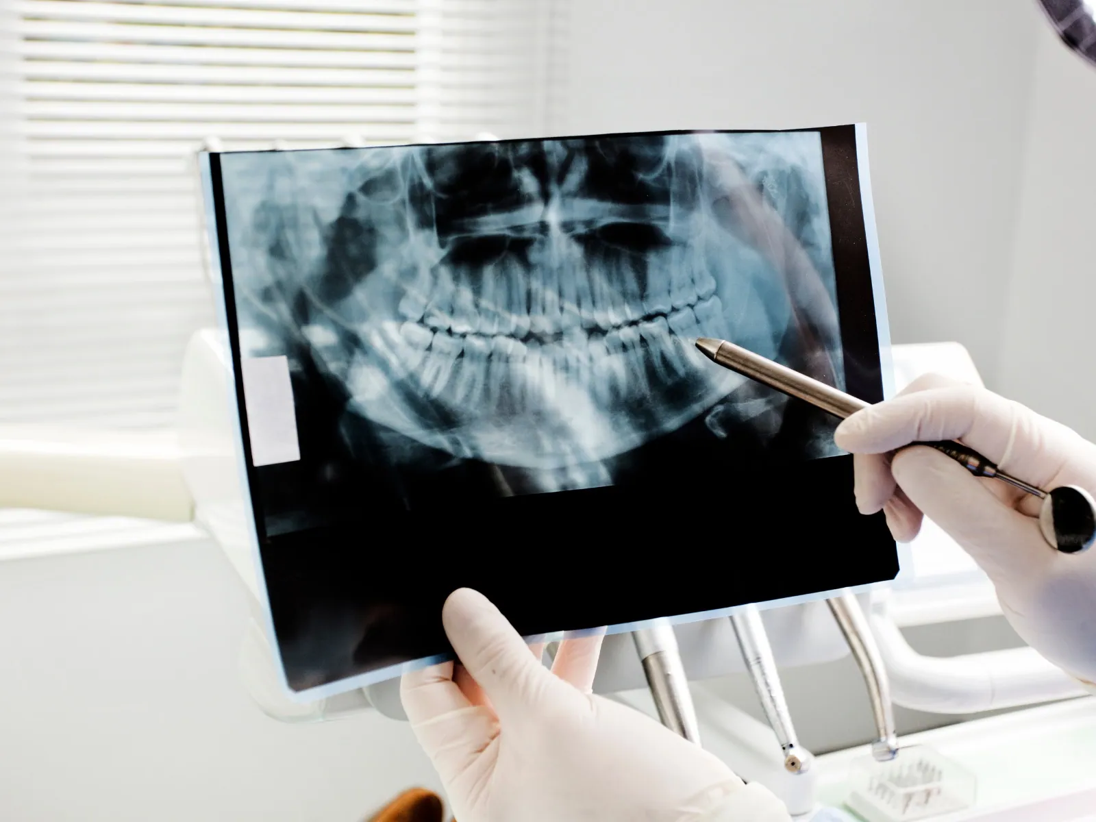 Digital dental X-ray and exam at Urban Dental Care