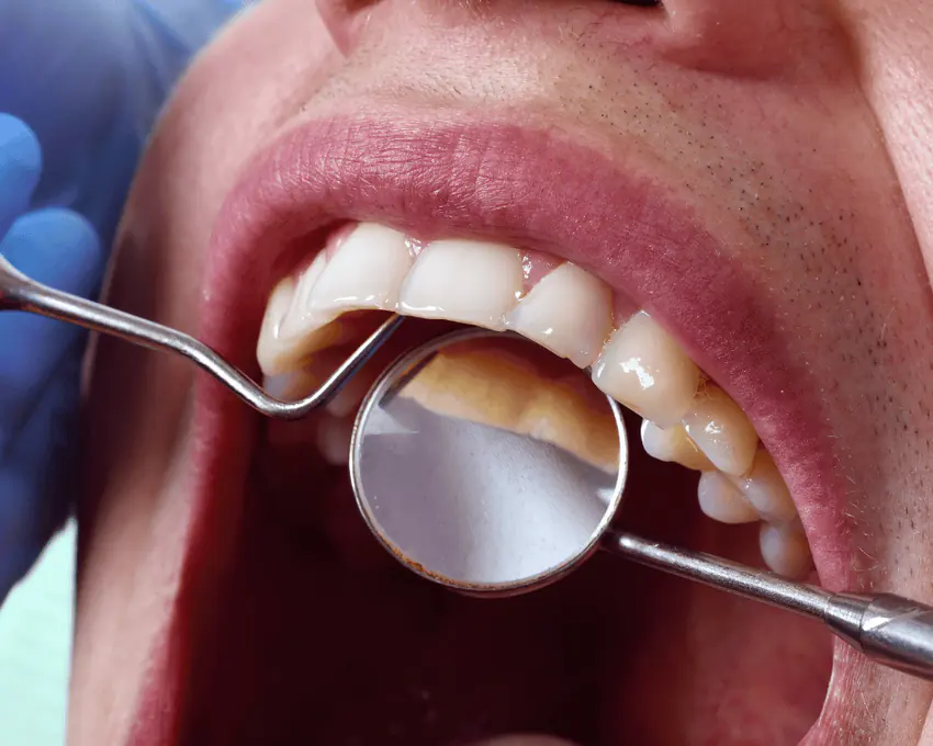 Dental mirror and instrument examining the inside surfaces of front teeth
