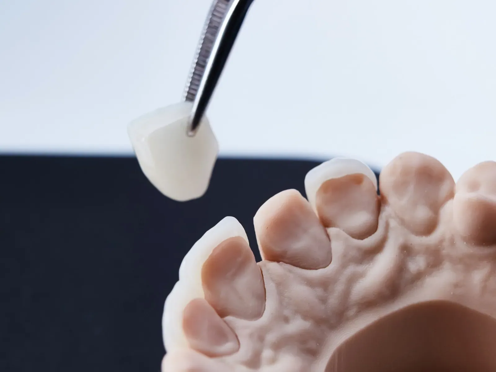 Thin dental veneer held above a model of prepared front teeth