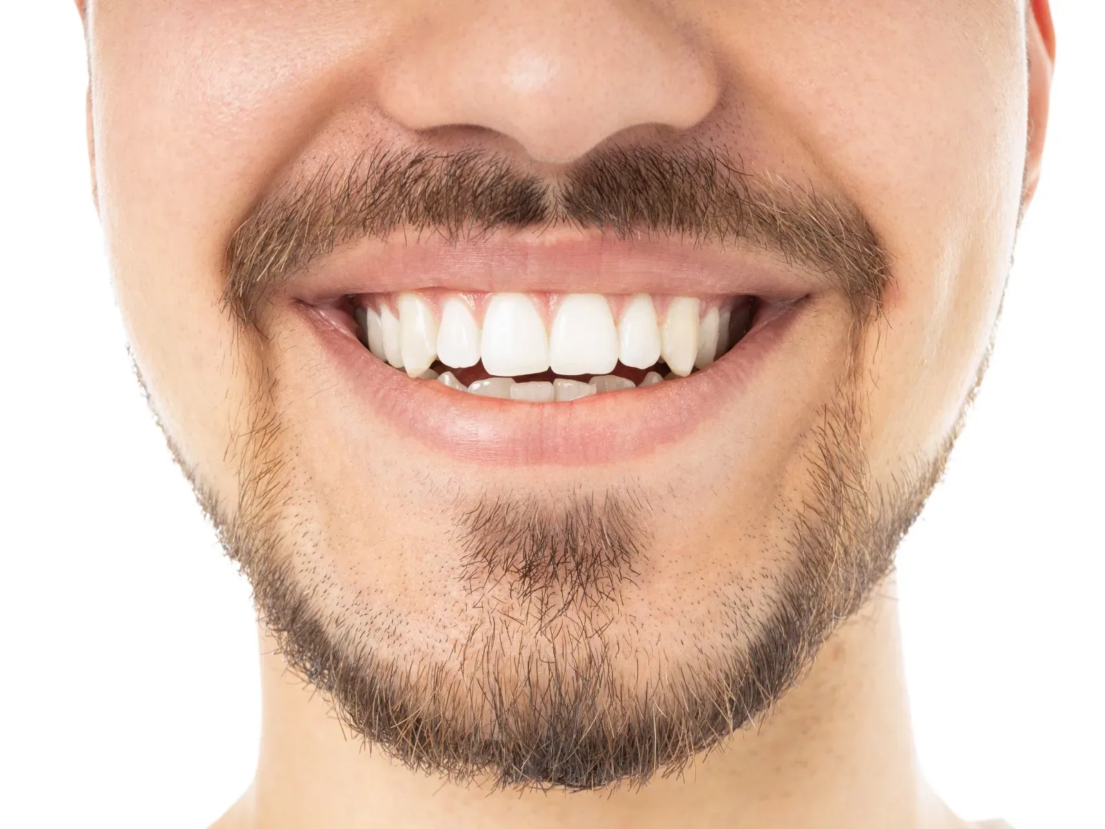 Close view of an adult smile and front teeth