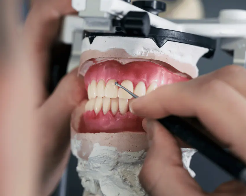 Hands adjusting a denture on a dental model