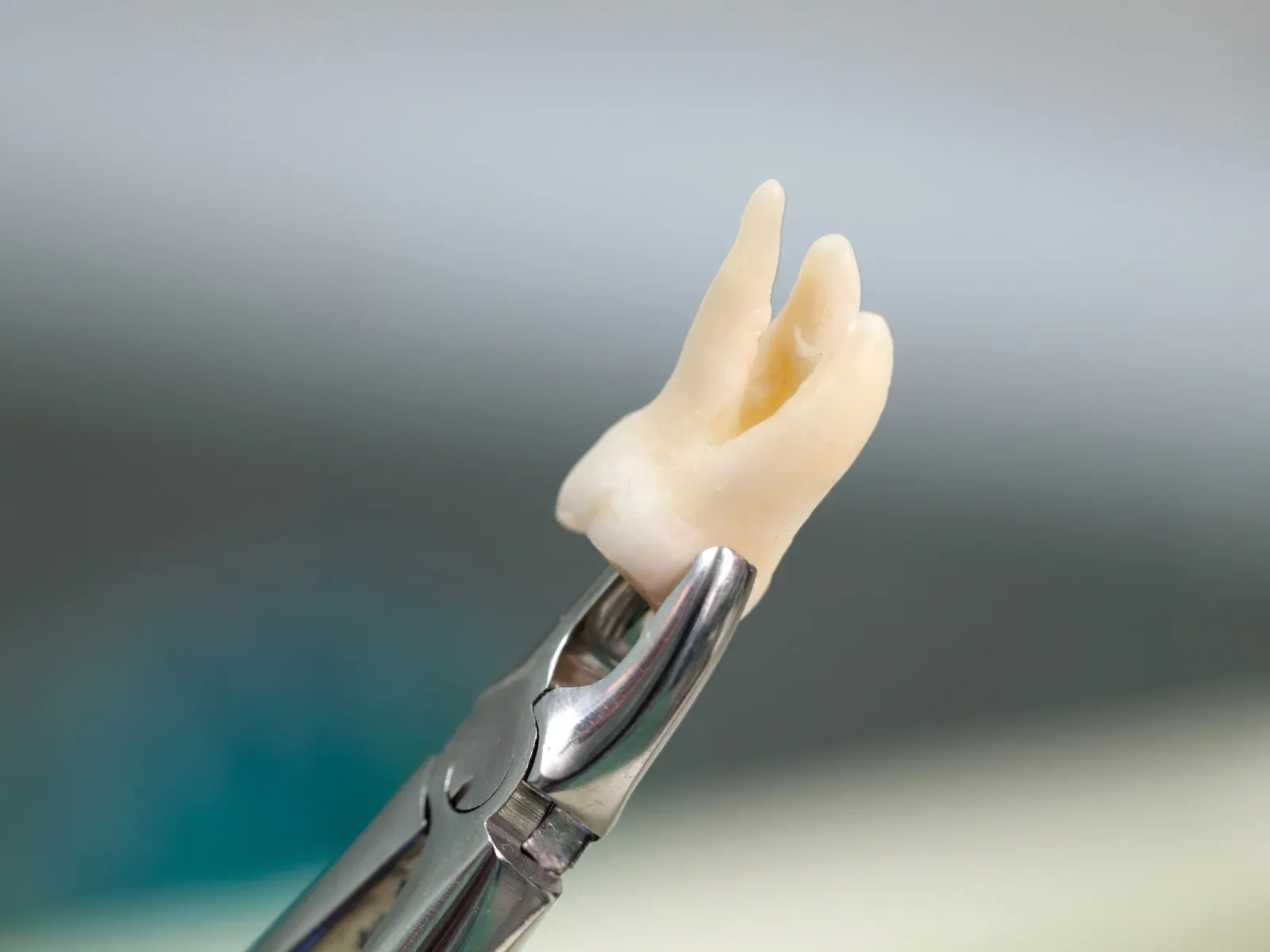 Extracted molar held with dental forceps