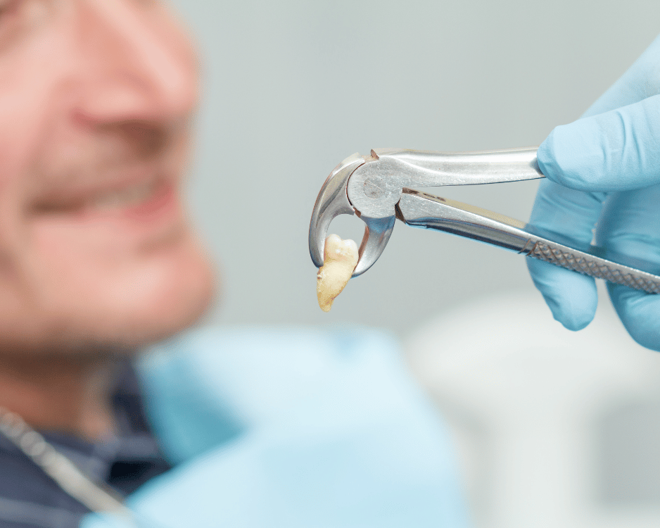 Comfort-focused tooth extraction appointment in Woodridge